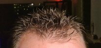 haar.jpg