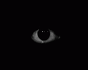 black-eye.gif