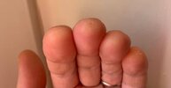 example-of-guitar-calluses.jpg
