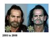 before-and-after-drugs-2-638.jpg